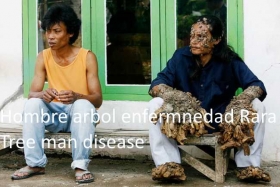 Hombrearbol.jpg